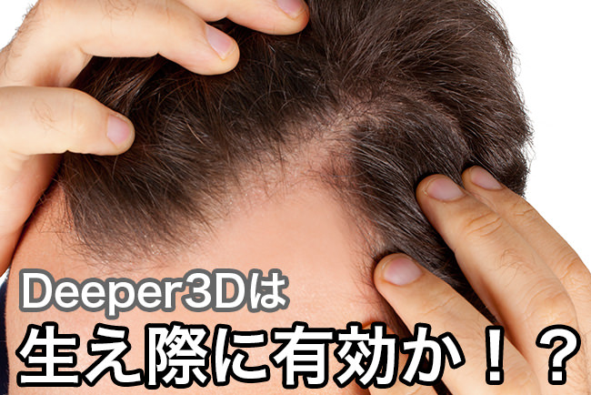 Deeper3Dは生え際の薄毛（M字ハゲ含む）を改善させるのか！？